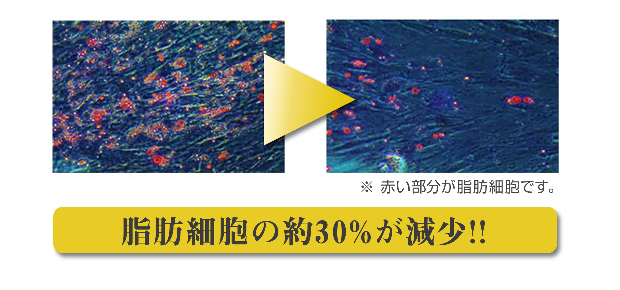 BNLS_neoの効果を実証-銀座国際美容外科