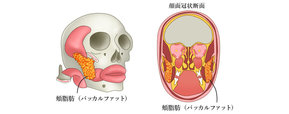 顔面環状断面,Buccalfat(バッカルファット)-銀座国際美容外科