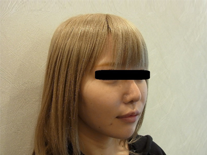 mailerfat(メーラーファット)-銀座国際美容外科