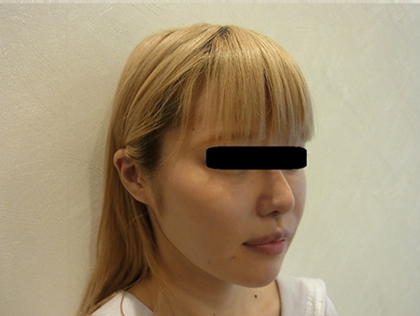 mailerfat(メーラーファット)-銀座国際美容外科