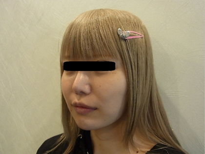 mailerfat(メーラーファット)-銀座国際美容外科