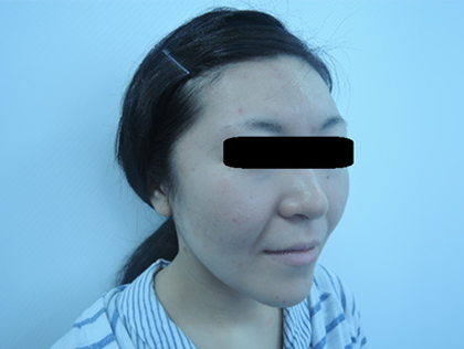 mailerfat(メーラーファット)-銀座国際美容外科