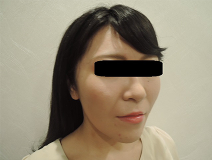 mailerfat(メーラーファット)-銀座国際美容外科