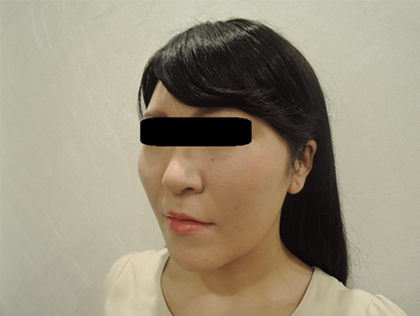 mailerfat(メーラーファット)-銀座国際美容外科