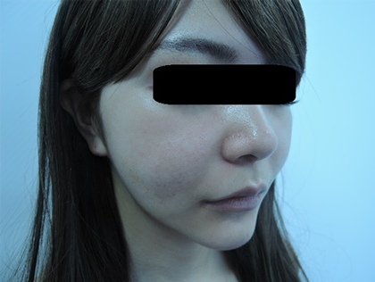 mailerfat(メーラーファット)-銀座国際美容外科