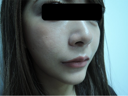mailerfat(メーラーファット)-銀座国際美容外科
