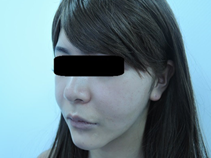 mailerfat(メーラーファット)-銀座国際美容外科