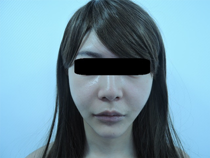 mailerfat(メーラーファット)-銀座国際美容外科