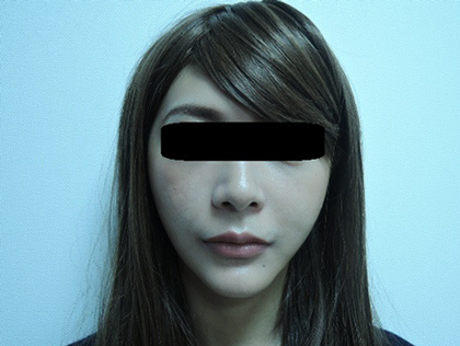 mailerfat(メーラーファット)-銀座国際美容外科
