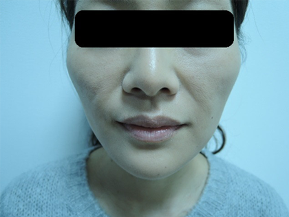 mailerfat(メーラーファット)-銀座国際美容外科