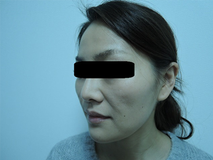 mailerfat(メーラーファット)-銀座国際美容外科