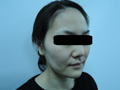 mailerfat(メーラーファット)-銀座国際美容外科