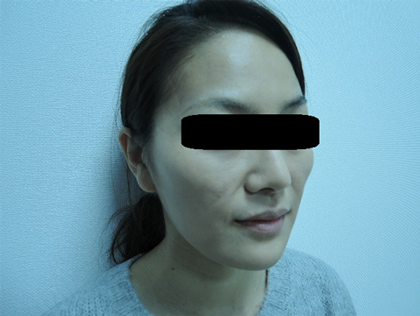 mailerfat(メーラーファット)-銀座国際美容外科