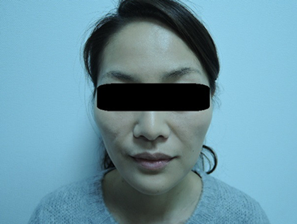 mailerfat(メーラーファット)-銀座国際美容外科