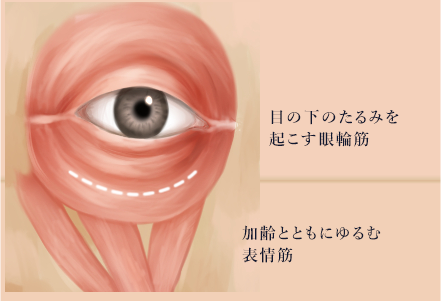目元の周りの眼輪筋と口角を引き上げる筋肉