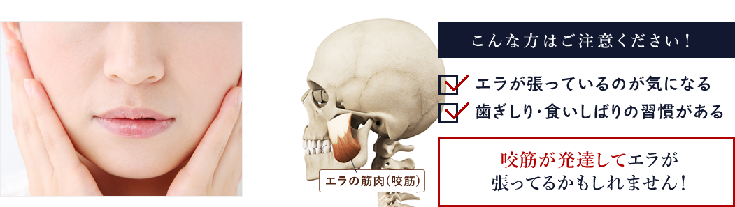エラボトックス注意