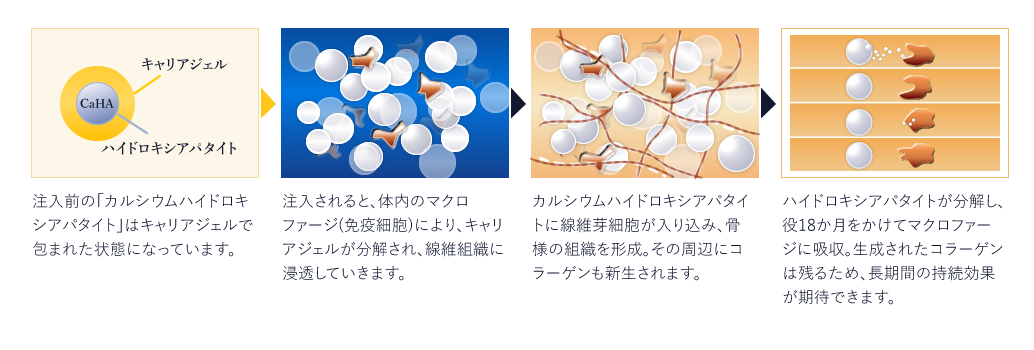 レディエッセ説明